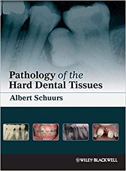 Pathology of the Hard Dental Tissues