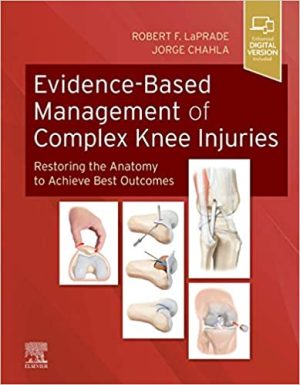 Evidence-Based Management of Complex Knee Injuries Restoring the Anatomy to Achieve Best Outcomes