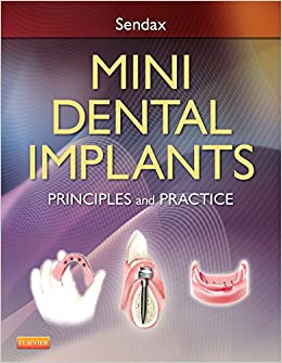 Mini Dental Implants Principles And Practice