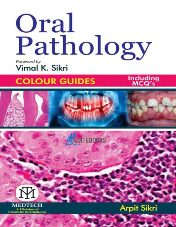 Oral Pathology Colour Guides By Arpit Sikri
