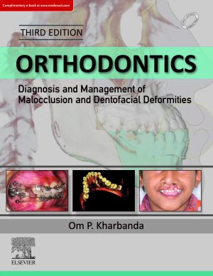 Orthodontics Diagnosis and Management of Malocclusion and Dentofacial Deformities