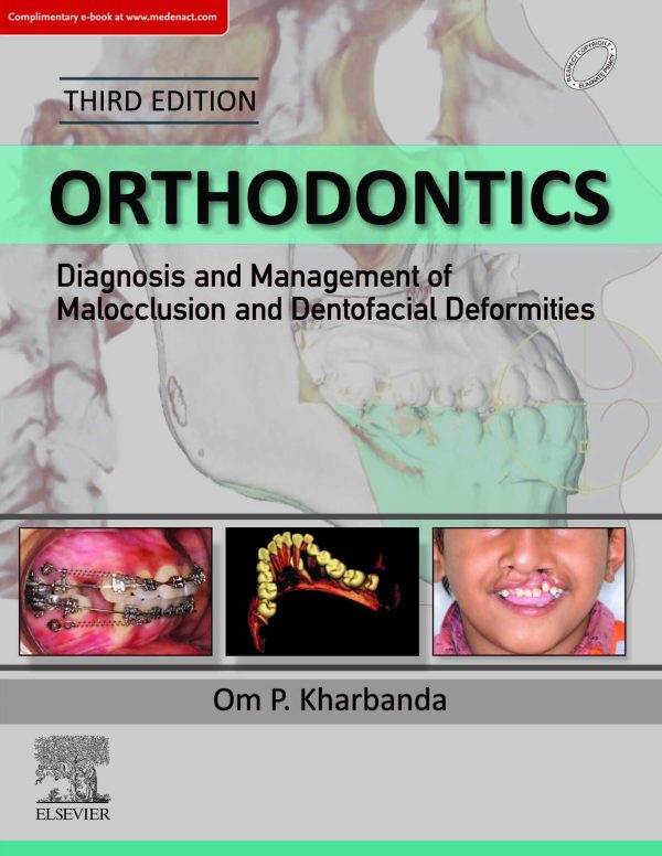 Orthodontics Diagnosis and Management of Malocclusion and Dentofacial Deformities
