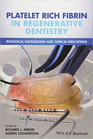 Platelet Rich Fibrin in Regenerative Dentistry Biological Background and Clinical Indications