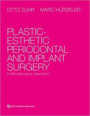 Plastic Esthetic Periodontal And Implant Surgery A Microsurgical Approach