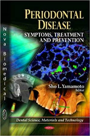 Periodontal Disease Symptoms Treatment and Prevention