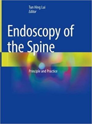 Endoscopy of the Spine Principle and Practice