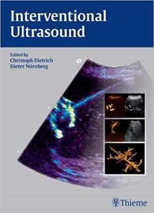 Interventional Ultrasound A Practical Guide and Atlas