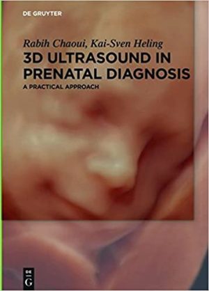 3D Ultrasound in Prenatal Diagnosis A Practical Approach