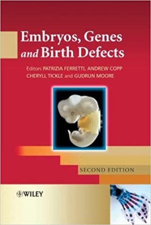 Embryos Genes and Birth Defects 2nd Edition