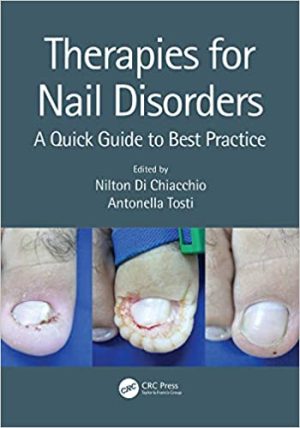 Therapies for Nail Disorders A Quick Guide to Best Practice