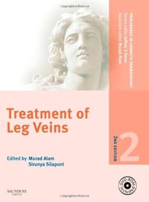 Procedures in Cosmetic Dermatology Series Treatment of Leg Veins 2nd Edition