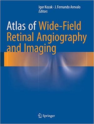 Atlas of Wide Field Retinal Angiography and Imaging