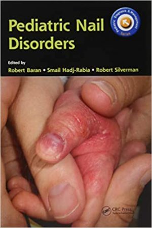 Pediatric Nail Disorders