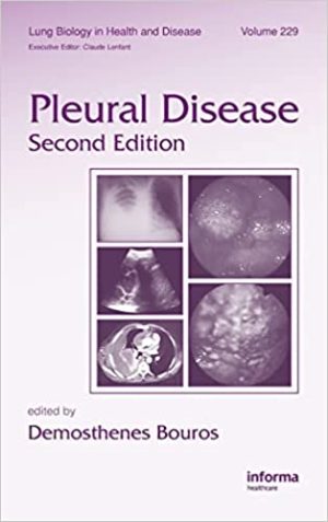 Pleural Disease 2nd Edition