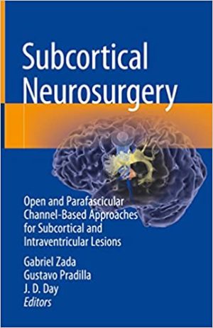 Subcortical Neurosurgery Open and Parafascicular Channel Based Approaches for Subcortical and Intraventricular Lesions