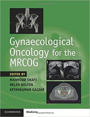 Gynaecological Oncology for the MRCOG