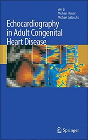 Echocardiography in Adult Congenital Heart Disease