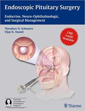 Endoscopic Pituitary Surgery Endocrine Neuro Ophthalmologic and Surgical Management