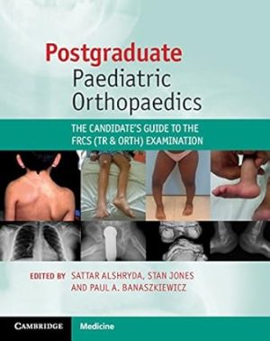 Postgraduate Paediatric Orthopaedics The Candidates Guide to the FRCS Tr and Orth Examination