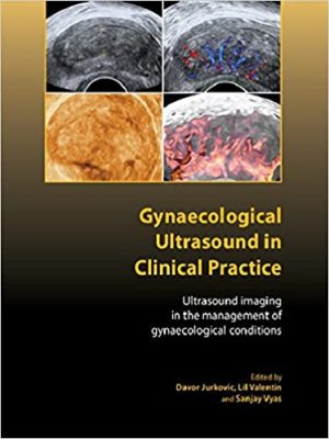 Gynaecological Ultrasound in Clinical Practice Ultrasound Imaging in the Management of Gynaecological Conditions