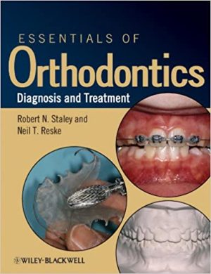 Essentials of Orthodontics Diagnosis and Treatment