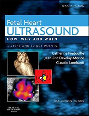 Fetal Heart Ultrasound How Why and When