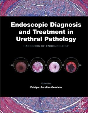 Endoscopic Diagnosis and Treatment in Urethral Pathology Handbook of Endourology