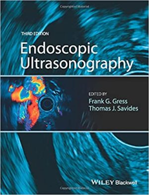 Endoscopic Ultrasonography