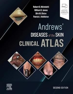 Andrews Diseases of the Skin Clinical Atlas 2nd Edition