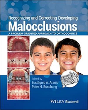 Recognizing and Correcting Developing Malocclusions A Problem Oriented Approach to Orthodontics