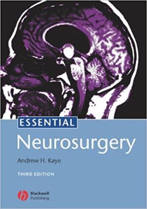 Essential Neurosurgery 3rd Edition