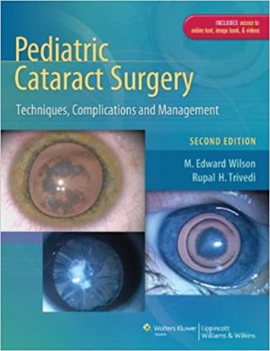 Pediatric Cataract Surgery Techniques Complications and Management 2nd Edition