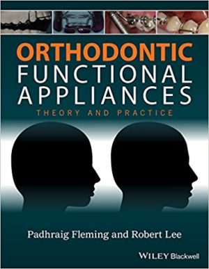 Orthodontic Functional Appliances Theory and Practice