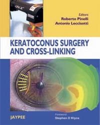 Keratoconus Surgery and Cross linking