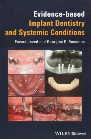 Evidence based Implant Dentistry and Systemic Conditions