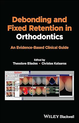 Debonding and Fixed Retention in Orthodontics An Evidence Based Clinical Guide