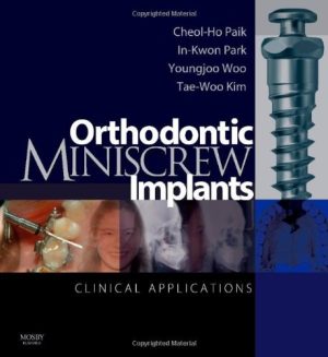Orthodontic Miniscrew Implants Clinical Applications