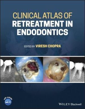 Clinical Atlas of Retreatment in Endodontics