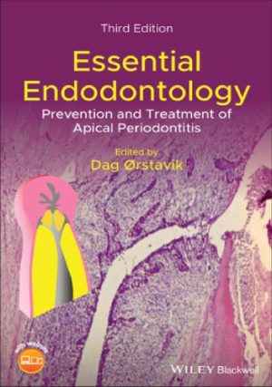 Essential Endodontology Prevention and Treatment of Apical Periodontitis 3rd Edition